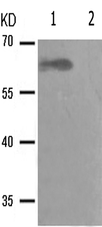 兔抗RELA(Phospho-Ser281) 多克隆抗体