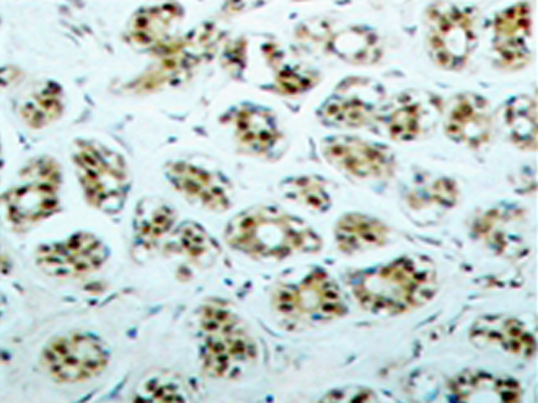 兔抗RELA(phospho-Ser311) 多克隆抗体