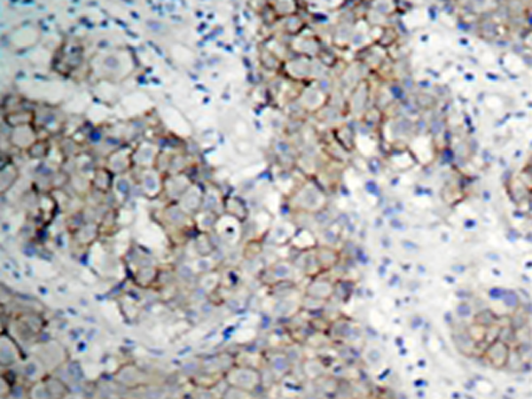 兔抗IGF1R(Phospho-Tyr1161) 多克隆抗体