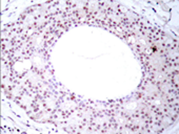 兔抗RELA (Phospho-Thr254) 多克隆抗体