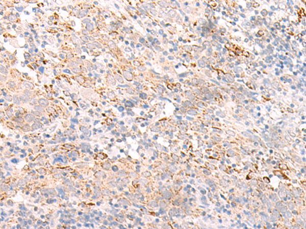 兔抗IFNL2多克隆抗体 