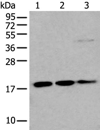 兔抗UBE2C多克隆抗体  