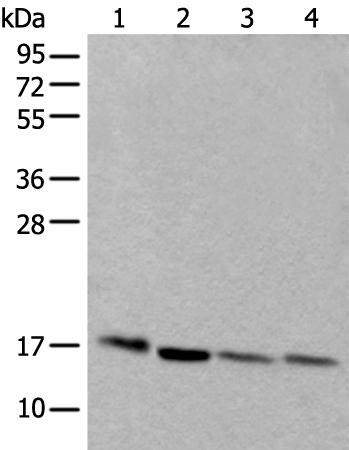 兔抗UBE2D3多克隆抗体