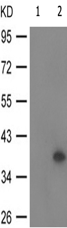 兔抗NFKBIA(Phospho-Tyr305) 多克隆抗体