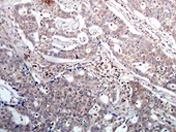 兔抗NFKBIB (Phospho-Ser23) 多克隆抗体