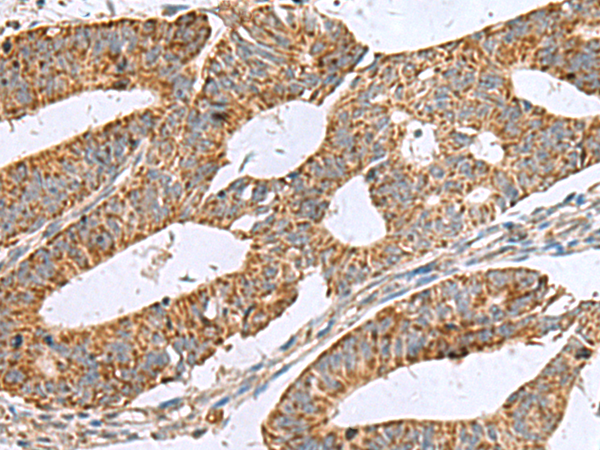 兔抗NFS1多克隆抗体