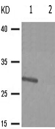 兔抗IGFBP3(Phospho-Ser183) 多克隆抗体