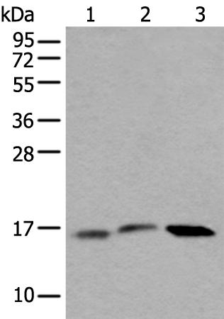 兔抗UBE2G2多克隆抗体 