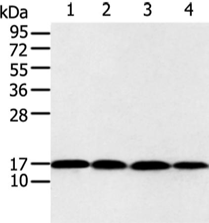兔抗UBE2I多克隆抗体   