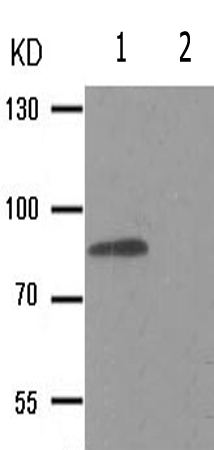 兔抗IKBKB(Phospho-Tyr188) 多克隆抗体 