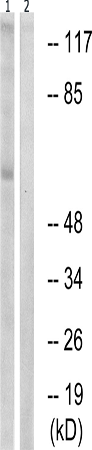 兔抗IL2RB(Phospho-Tyr364) 多克隆抗体