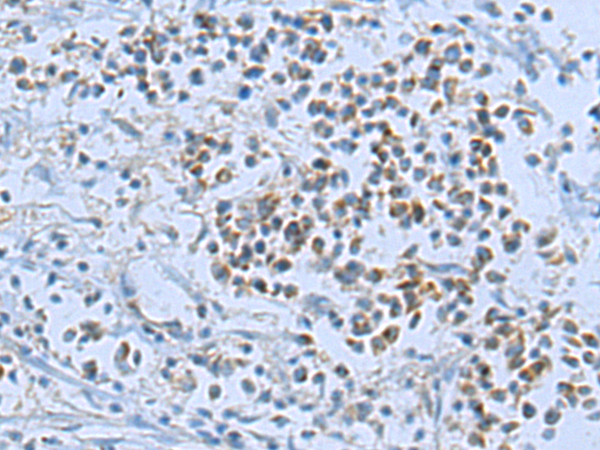 兔抗RND3多克隆抗体