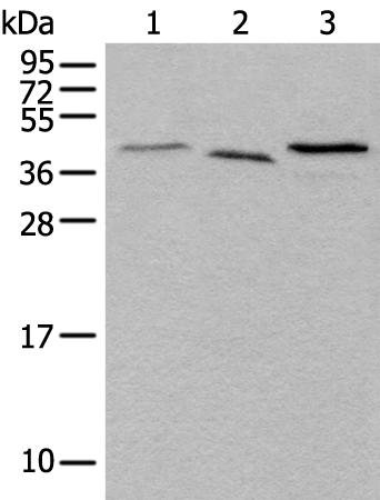 兔抗UBXN1多克隆抗体  