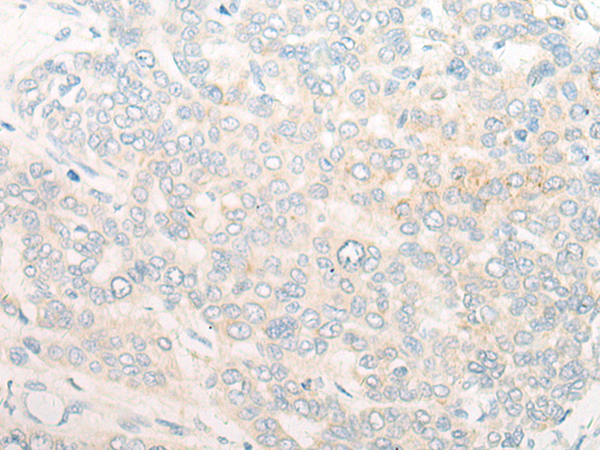 兔抗RNF19A多克隆抗体