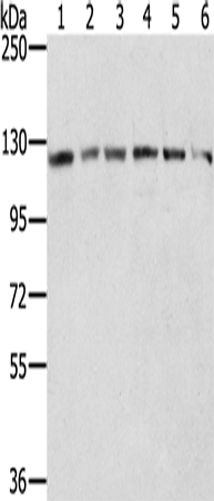 兔抗RNF20多克隆抗体