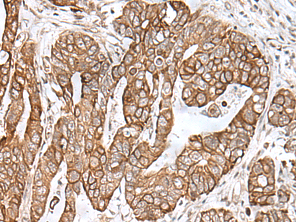 兔抗RNF111多克隆抗体 