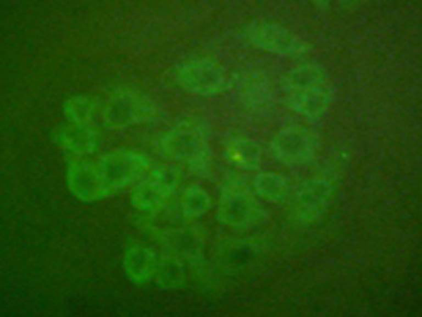 兔抗NR3C1(Ab-211) 多克隆抗体