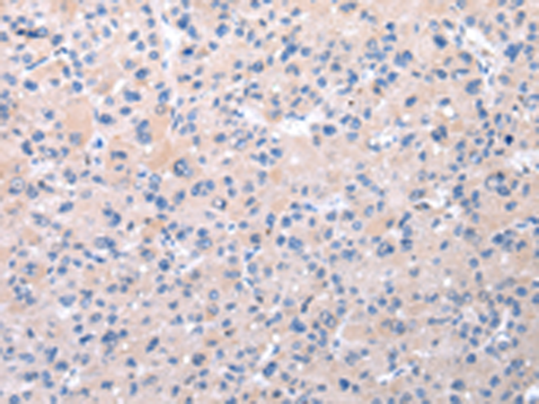 兔抗RNF115多克隆抗体