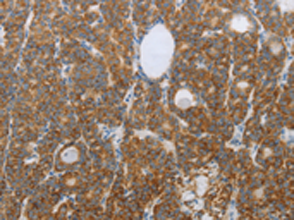 兔抗RNF126多克隆抗体