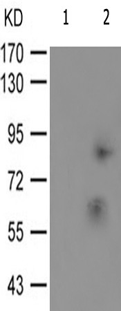 兔抗NR3C1(Phospho-Ser203) 多克隆抗体