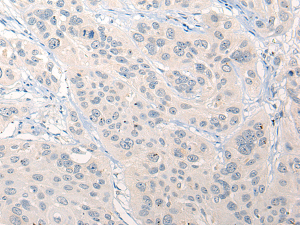 兔抗RNF138多克隆抗体
