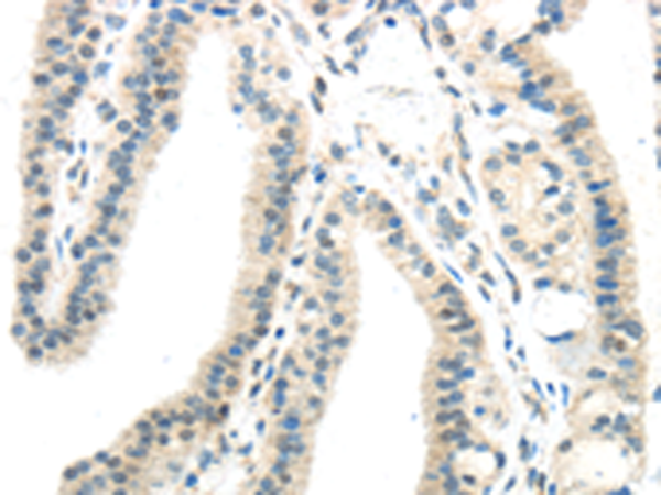 兔抗IL12A多克隆抗体 