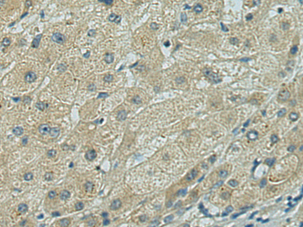 兔抗RPL10L多克隆抗体