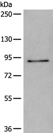 兔抗UNC5A多克隆抗体 