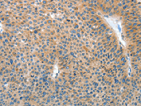 兔抗IL22RA1多克隆抗体 