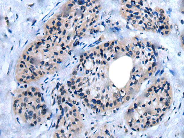 兔抗UNC93B1多克隆抗体 