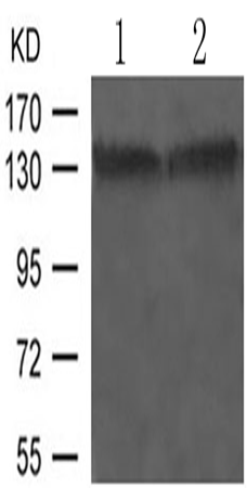 兔抗NTRK1 (Phospho-Ser791)多克隆抗体