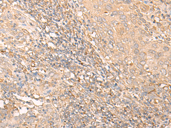 兔抗IL34多克隆抗体  
