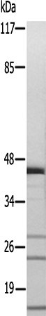 兔抗RPL36多克隆抗体