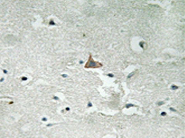 兔抗NTRK2(Phospho-Tyr706Tyr707) 多克隆抗体