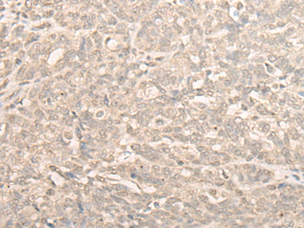 兔抗NUBP2多克隆抗体