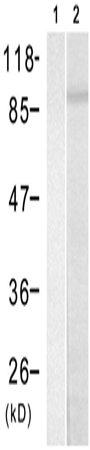 兔抗RPS6KA1 (Phospho-Ser352)多克隆抗体