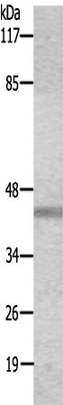兔抗USF2多克隆抗体
