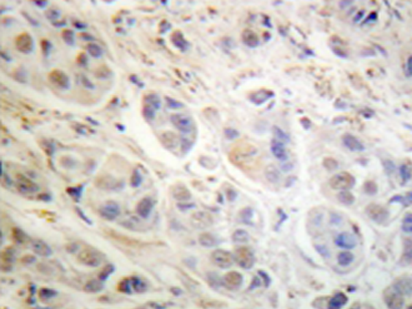 兔抗RPS6KA1(Ab-573) 多克隆抗体