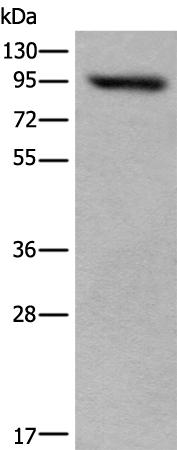 兔抗USP6NL多克隆抗体   