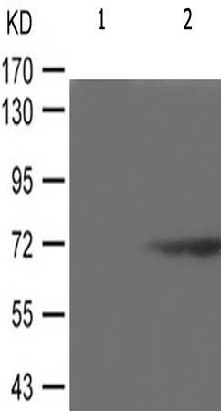 兔抗RPS6KB1(Phospho-Ser371) 多克隆抗体