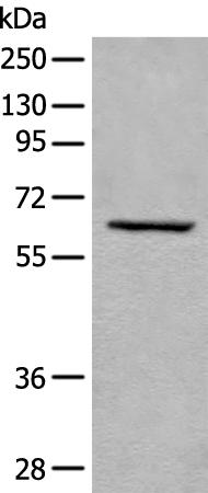 兔抗USP14多克隆抗体  