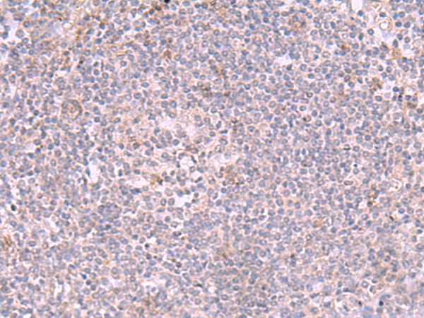 兔抗INPP5K多克隆抗体