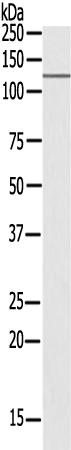 兔抗USP38多克隆抗体  