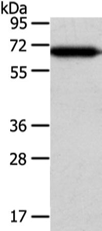 兔抗USP39多克隆抗体 