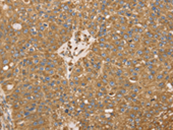 兔抗RRBP1多克隆抗体