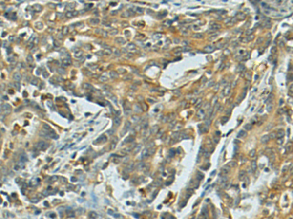 兔抗ORAI1(L1)多克隆抗体
