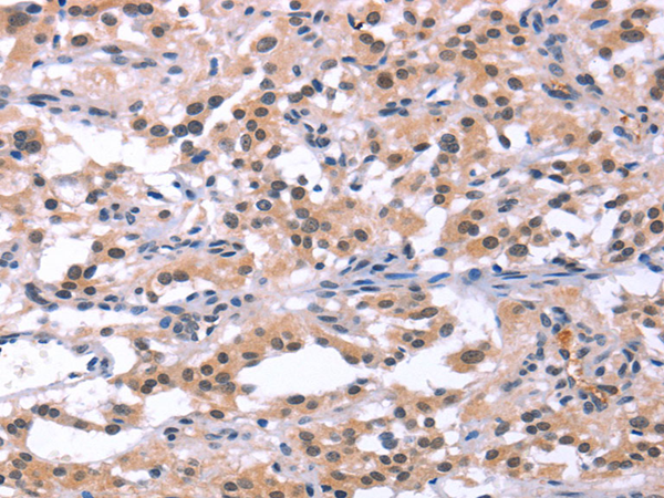 兔抗ORAI1(L2)多克隆抗体