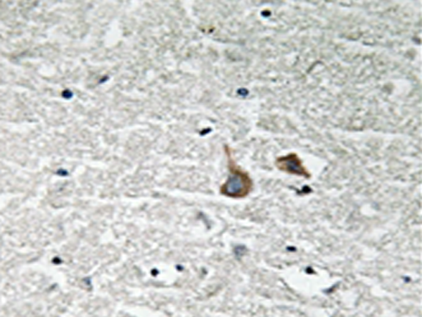 兔抗IRAK1(Phospho-Ser376) 多克隆抗体