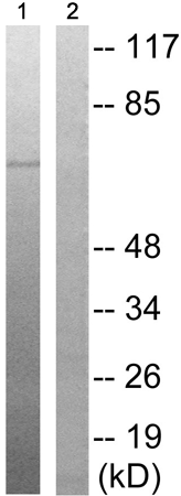 兔抗OXSR1(Phospho-Thr185) 多克隆抗体