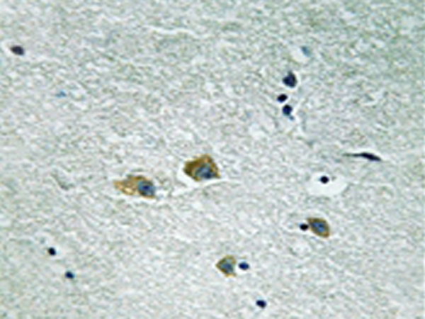 兔抗PAK1(Ab-204) 多克隆抗体